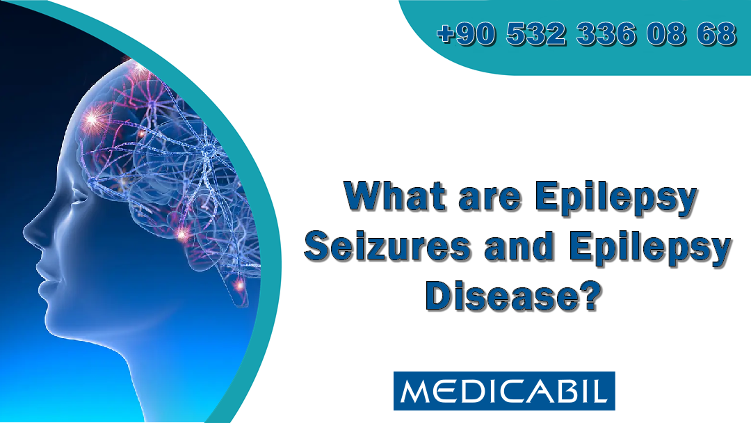 What are Epilepsy Seizures and Epilepsy Disease?