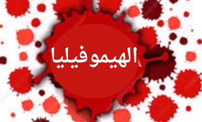 ما هي الهيموفيليا؟ ما هي أعراضها؟ كيف يتم علاجها؟