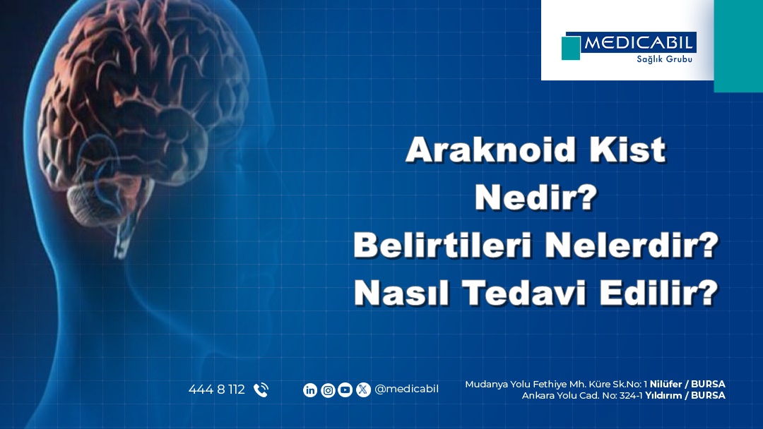 Araknoid Kist Nedir? Belirtileri Nelerdir? Nasıl Tedavi Edilir?