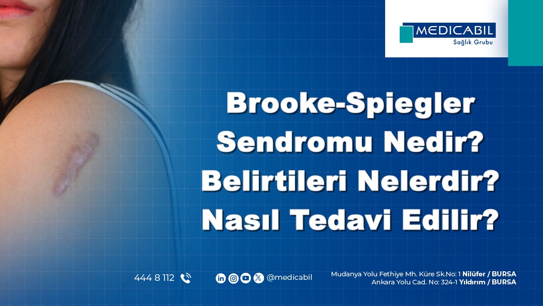 Brooke-Spiegler Sendromu Nedir? Belirtileri Nelerdir? Nasıl Tedavi Edilir?