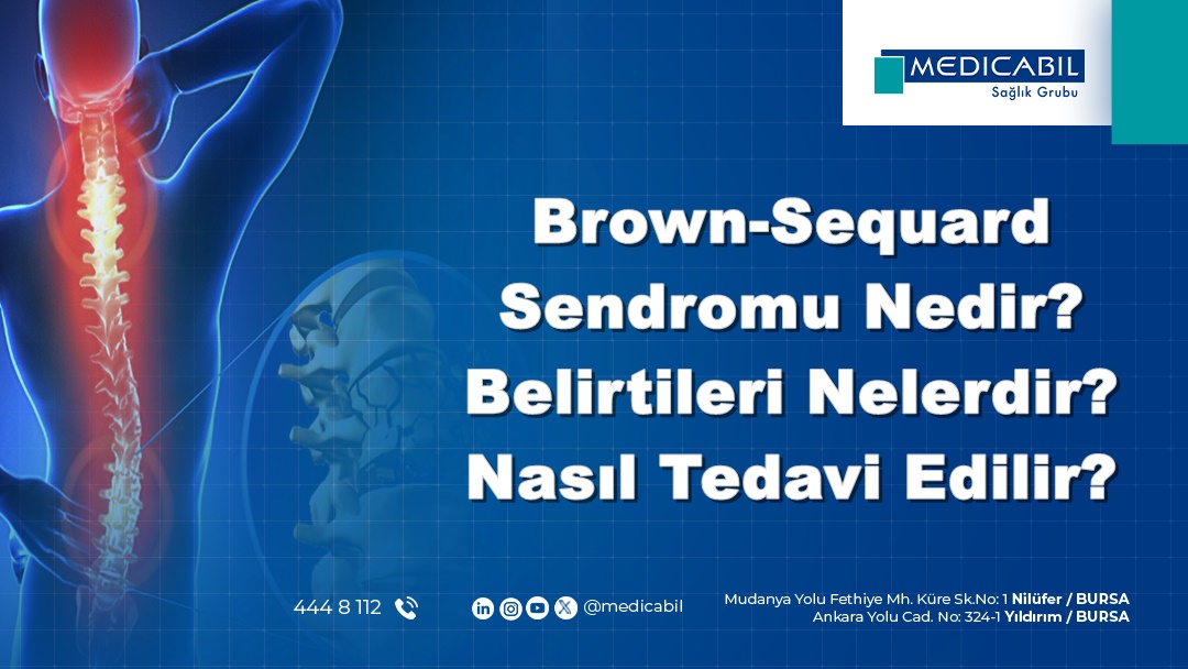 Brown-Sequard Sendromu Nedir? Belirtileri Nelerdir? Nasıl Tedavi Edilir?