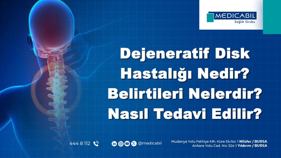 Dejeneratif Disk Hastalığı Nedir? Belirtileri Nelerdir? Nasıl Tedavi Edilir?