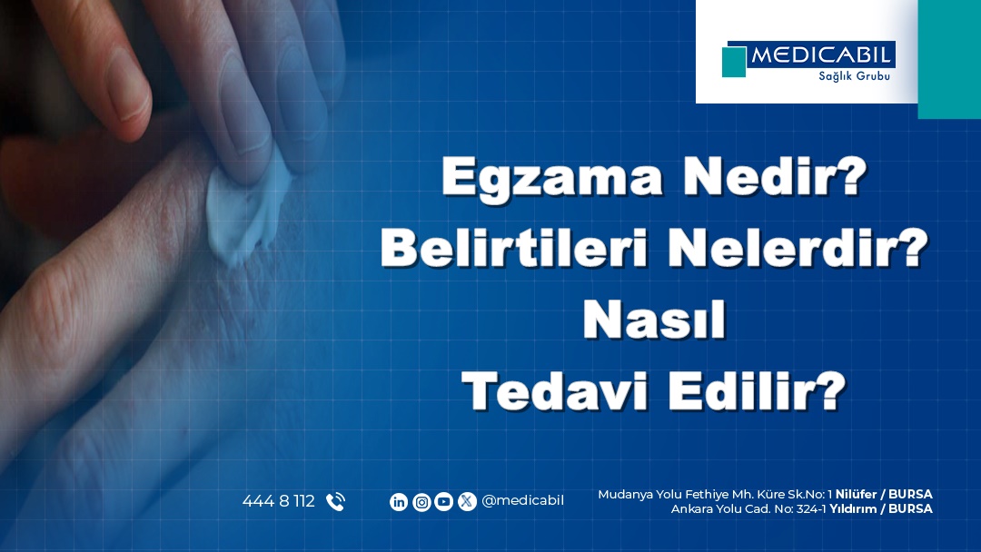 Egzama Nedir? Belirtileri Nelerdir? Nasıl Tedavi Edilir?