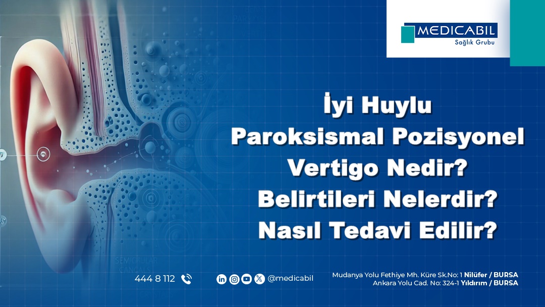 İyi Huylu (Benign) Paroksismal Pozisyonel Vertigo Nedir? Belirtileri Nelerdir? Nasıl Tedavi Edilir?