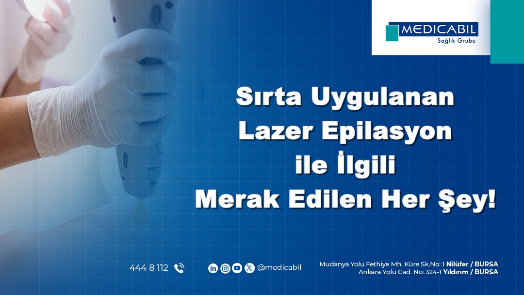 Sırta Uygulanan Lazer Epilasyon ile İlgili Merak Edilen Her Şey!