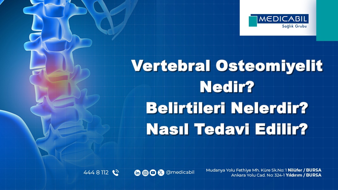 Vertebral Osteomiyelit Nedir? Belirtileri Nelerdir? Nasıl Tedavi Edilir?