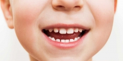  Çocuklarda Diş Temizliği